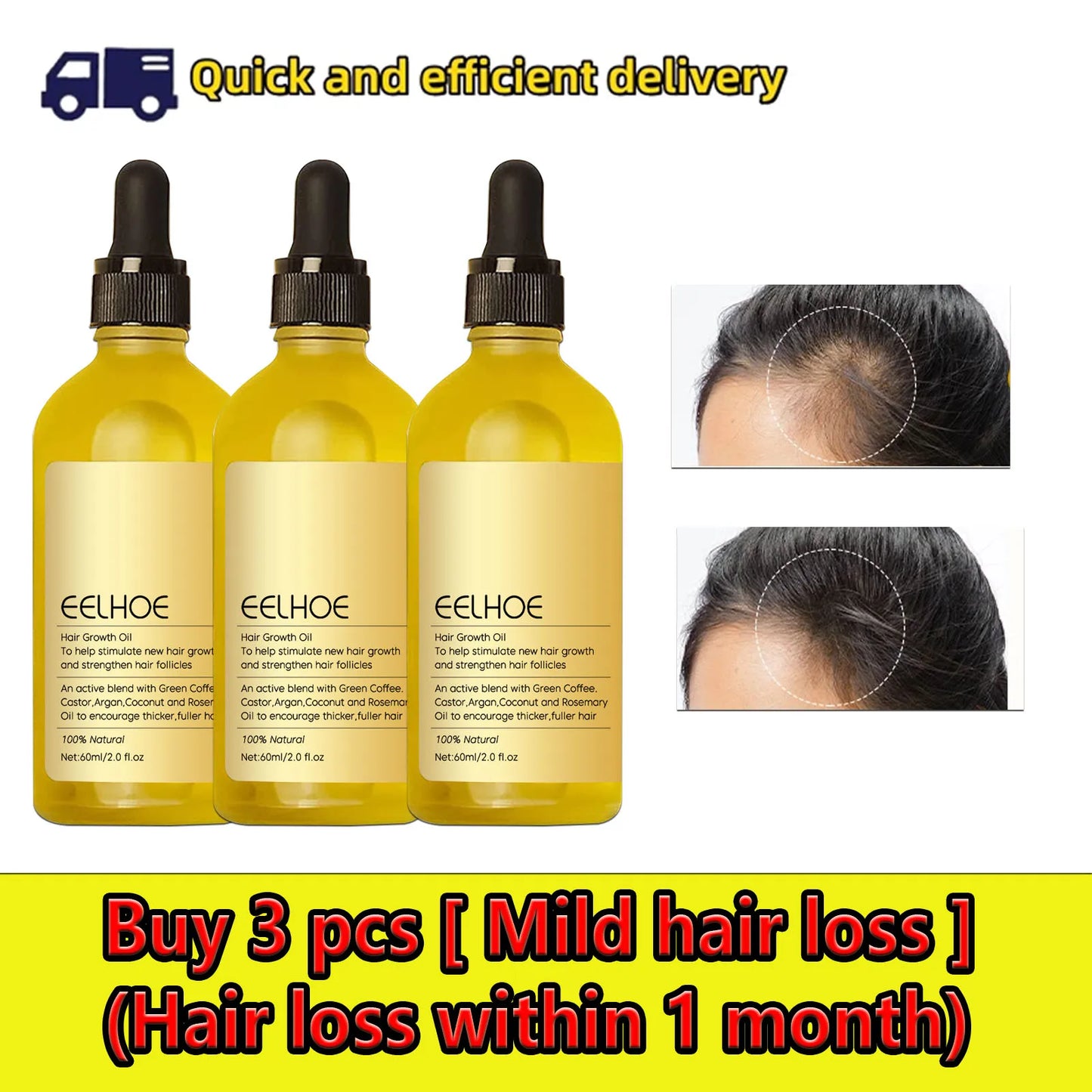 Hair Growth Products Prevent Hair Loss Essential Oil Fast Growing Anti-Drying Scalp Treatment Repair Beauty Health for Men Women